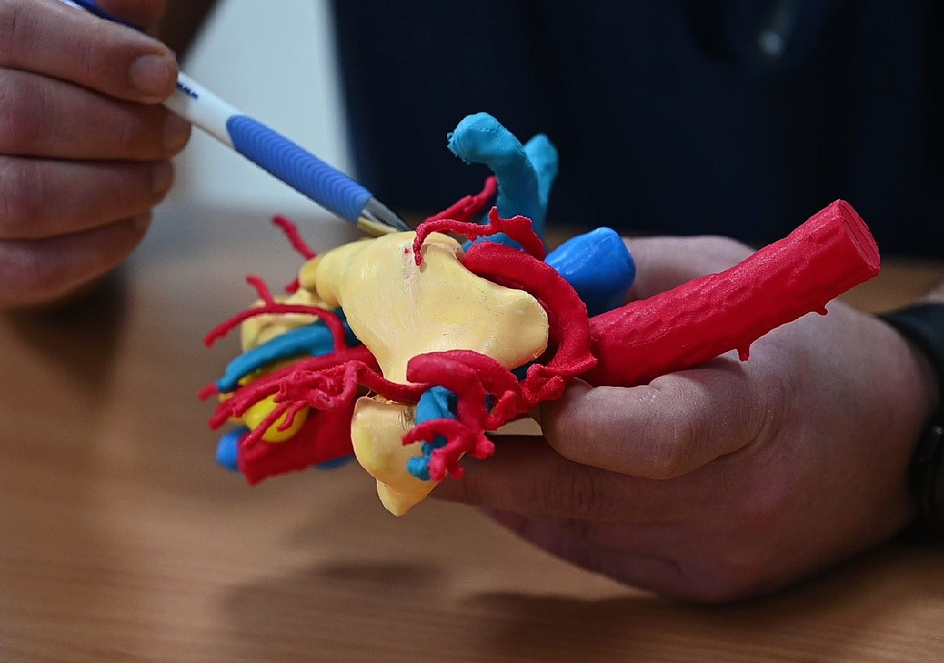 Video interview – Innovations help break down old methods, with 3d printing to open heart surgery