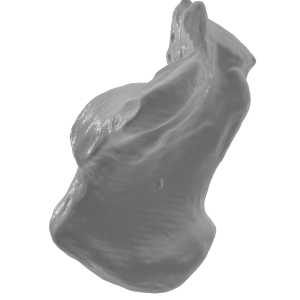 Реплика на петна коска (Calcaneus)